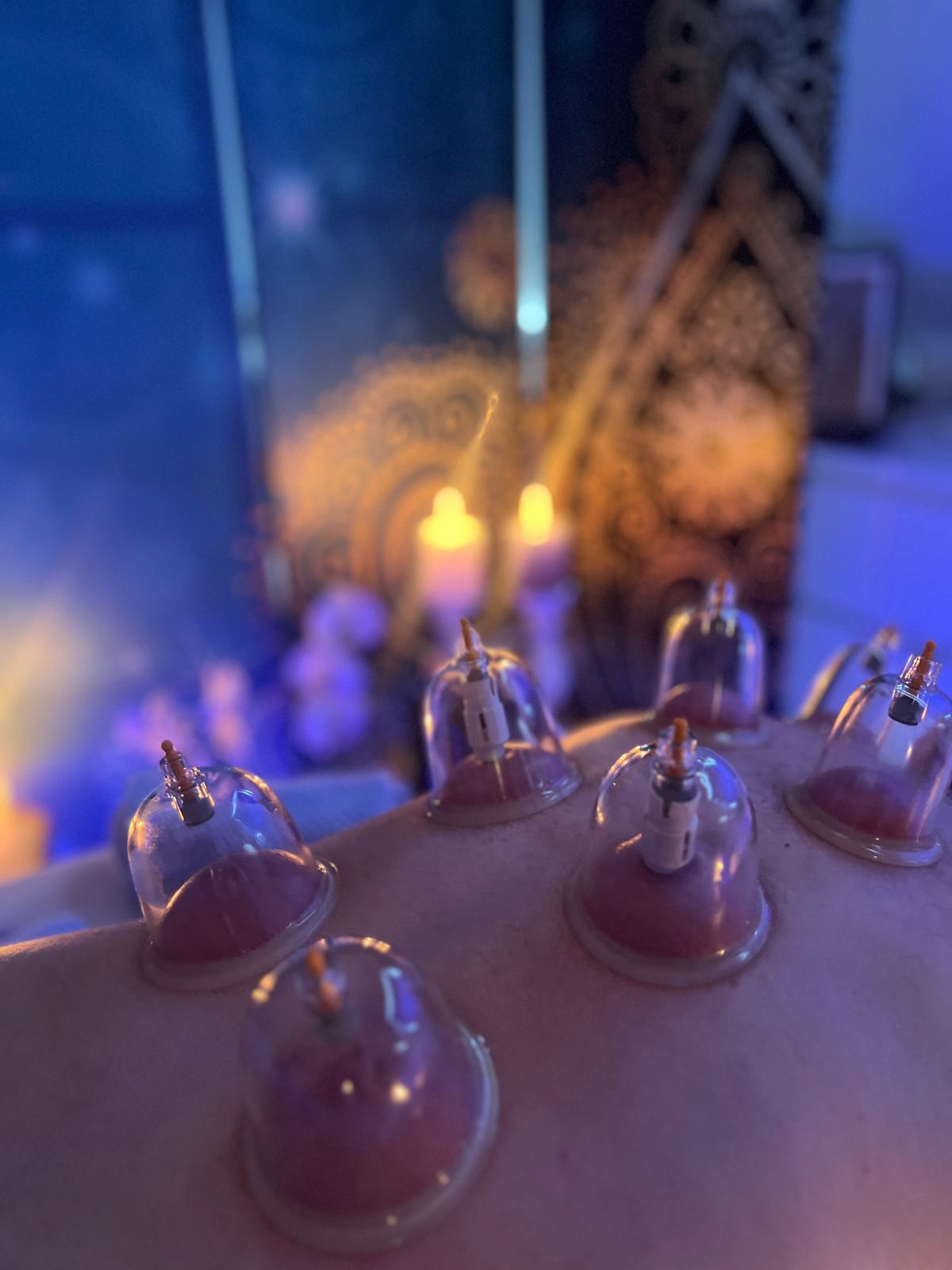 Schröpfmassage mit mehreren Schröpfgläsern auf dem Rücken